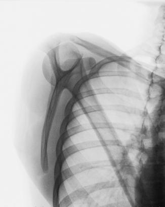 Fig. 5.103 lateral