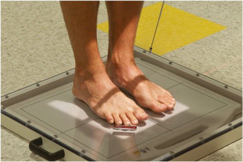 Fig. 6.67 AP—bilateral picioare (incidență taken pe digital receptorul de imagine).