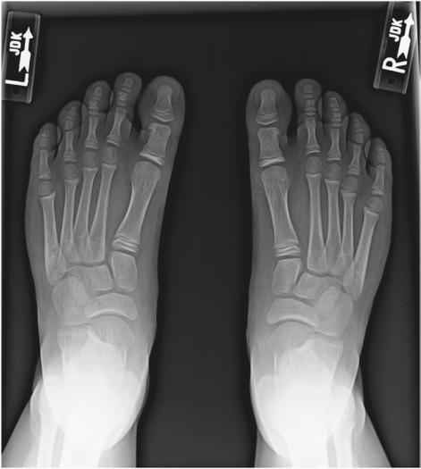 Fig. 6.68 AP weight-
