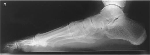 Fig. 6.71 Weight-