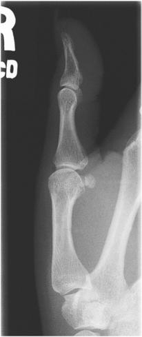 Fig. 4.60 lateral Police.