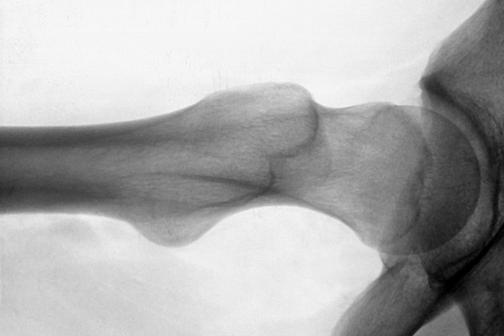 Fig. 7.81 Modified axiolateral incidență.
