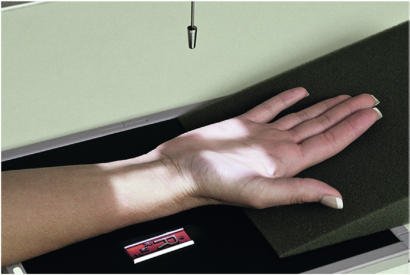 Fig. 4.87 Alternative AP Pumn (Articulație Radiocarpiană).
