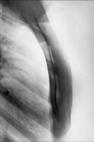 Fig. 10.25 lateral Stern.