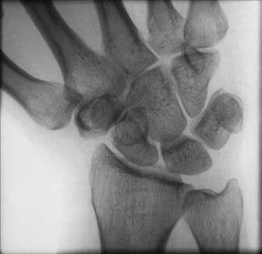 Fig. 4.110 Radial deviation.