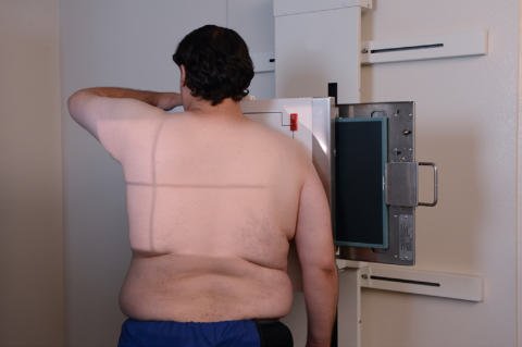 Fig. 2.74 Poziție oblică anterioară stângă (OAS / LAO) la 45°.