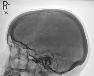 Fig. 11.112 profil.