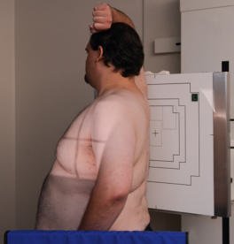 Fig. 2.80 Poziție oblică posterioară dreaptă (OPD / RPO) la 45°.