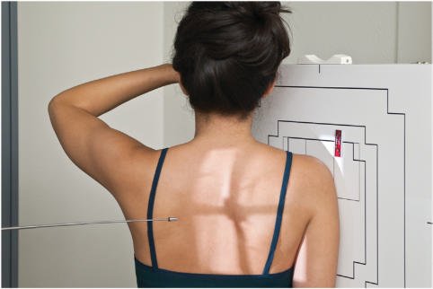 Fig. 5.77 PA oblic (scapular Y lateral) cu Raza centrală perpendiculară.