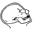 Fig. 11.194 Incidență parietoacantială—sinusuri. (Modificat după