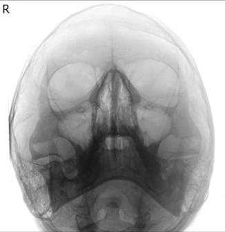 Figura 4