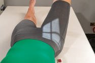 Fig. 7.78 unilateral modified Cleaves, 20-