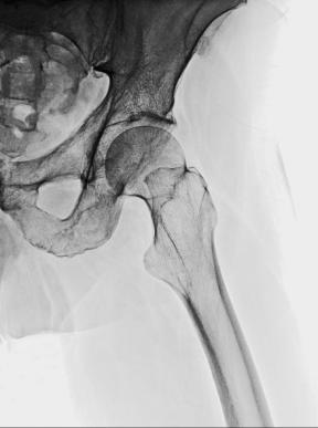 Fig. 7.76 45-