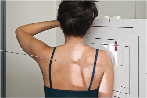 Fig. 5.82). • Collimation field size la aria de interes diagnostic.