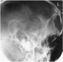 Fig. 11.183 gură închisă.
