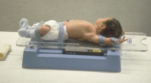 Figura 2