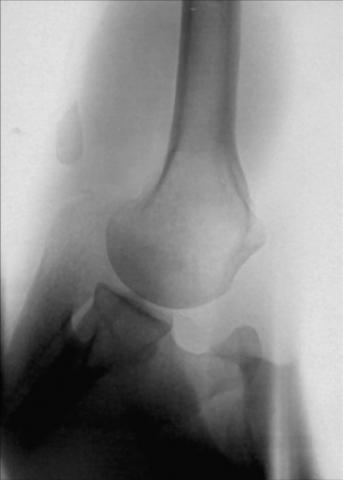 Figura 3
