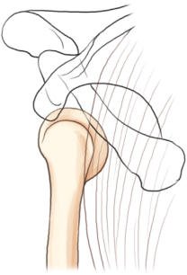 Fig. 5.84 posterior luxație / subluxație articulară,