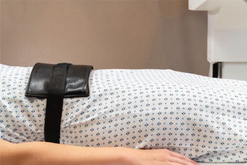 Fig. 14.83 Compresie ureterală, cu pelotele umflate poziționate