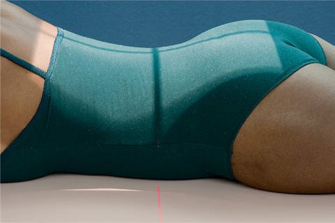 Fig. 14.80 Alternativă—PA în decubit ventral (postmicțional).