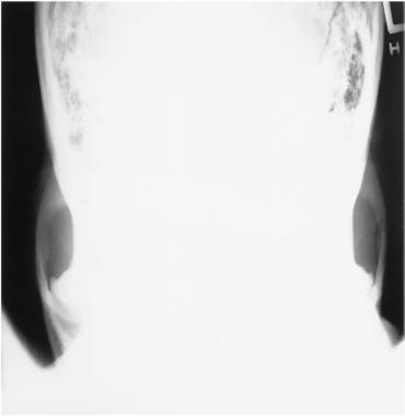 Fig. 11.150 AP axial.