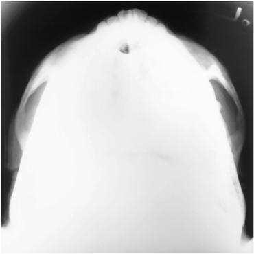 Fig. 11.145 SMV incidență.