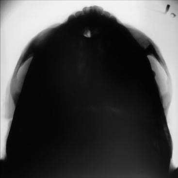 Figura 4