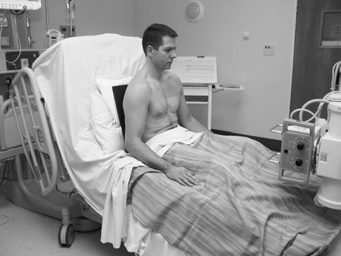 Radiografie de abdomen în incidență antero-posterioară (AP), în ortostatism, evidențiind intestinul subțire