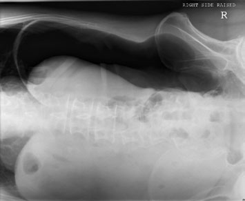 Figura 3: Aspect radiografic / Poziționare (Clark Ed. 12)