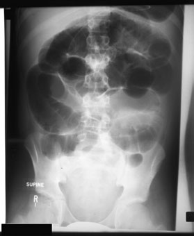 More specific referral criteria de abdominal radiografii sunt given