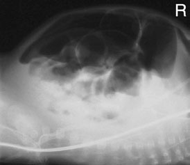 that described pentru neonatal chest radiografie în non-