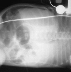 • abdomenul este normally distended în these cases. Care trebuie să