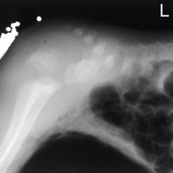combined Antero-posterior (AP) chest și Abdomen radiografie este
