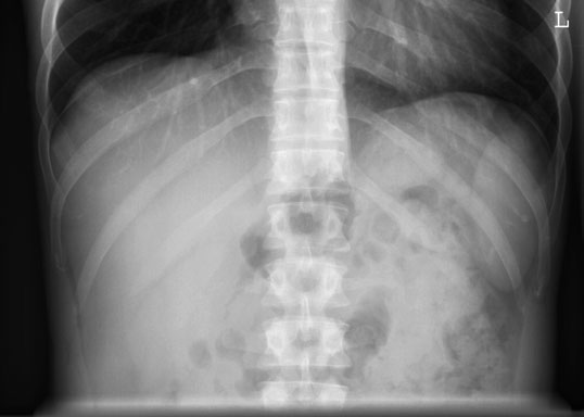 Figura 2: Aspect radiografic / Poziționare (Clark Ed. 12)