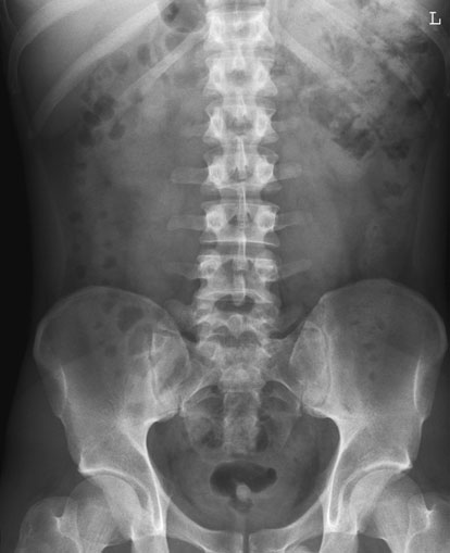 Figura 3: Aspect radiografic / Poziționare (Clark Ed. 12)