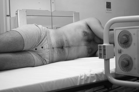 Imagine anteroposterioară (AP) a abdomenului în decubit lateral stâng care evidențiază aer liber