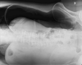 Figura 2: Aspect radiografic / Poziționare (Clark Ed. 12)
