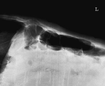 Figura 4: Aspect radiografic / Poziționare (Clark Ed. 12)
