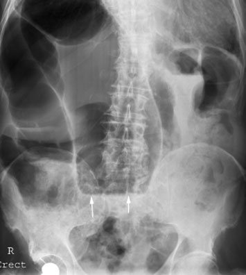 Figura 3: Aspect radiografic / Poziționare (Clark Ed. 12)