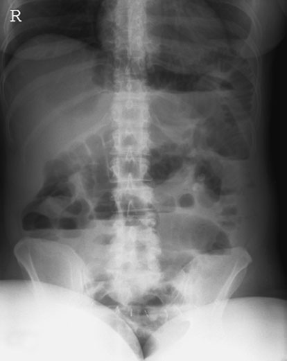 Figura 5: Aspect radiografic / Poziționare (Clark Ed. 12)