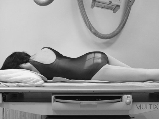 blood vessels, nerves). These suspiciune de fractură poate fie classified ca sta-