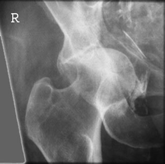 Figura 3: Aspect radiografic / Poziționare (Clark Ed. 12)