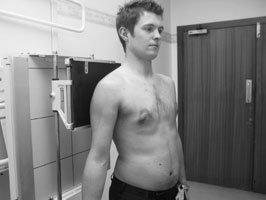 Antero-posterior (AP) radiografie de