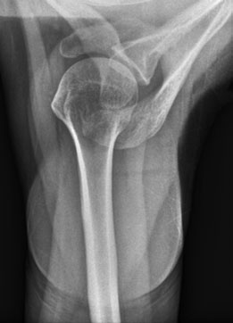 Figura 4: Aspect radiografic / Poziționare (Clark Ed. 12)