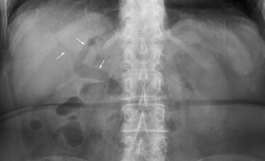 Figura 5: Aspect radiografic / Poziționare (Clark Ed. 12)