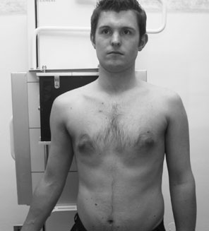 este normally required. în certain circumstances, subluxation de the