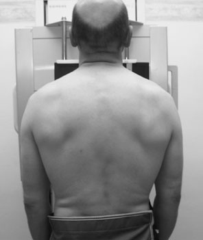 • radiographic expunere este similar la that given pentru an