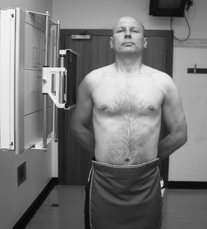 radiografie de normal Articulații Sternoclaviculare în Profil (lateral) incidență