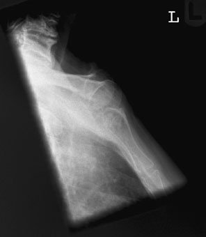 Figura 4: Aspect radiografic / Poziționare (Clark Ed. 12)