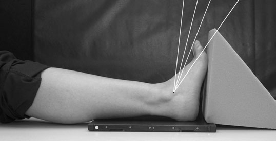 radiografie evidențiind effect de 40-grade